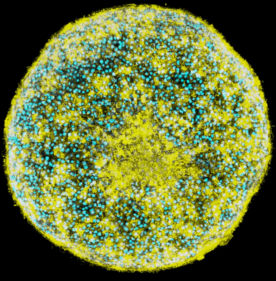 Microscopic image of gastrula single Microscopic image of gastrula single